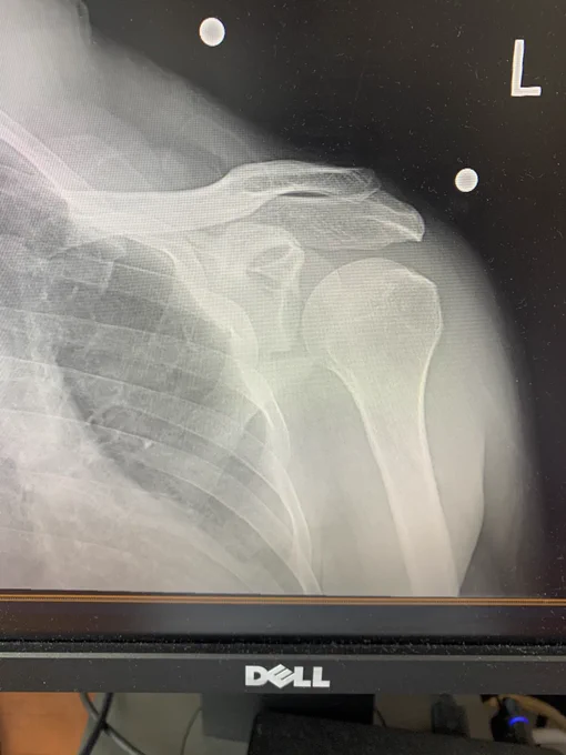 Image from Chase B. Ansok, MD (@ansokmd)