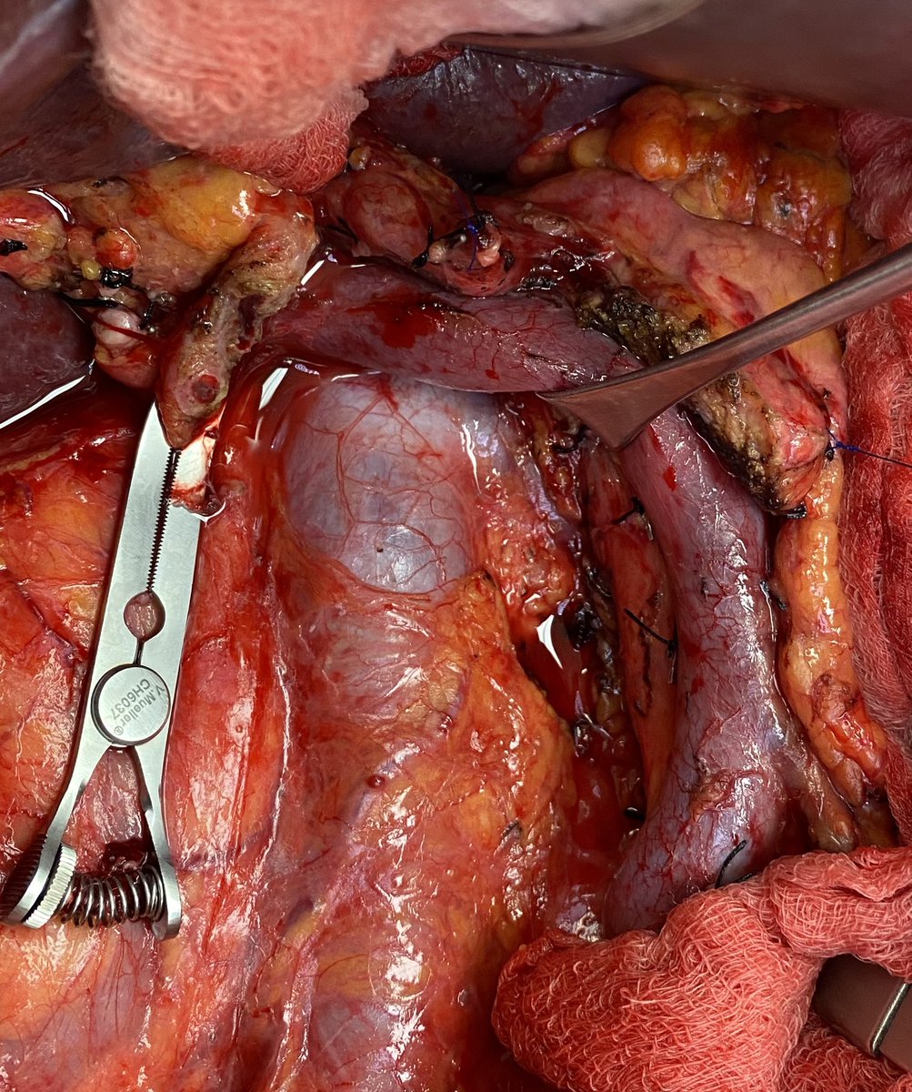 Jason W Denbo tweet media