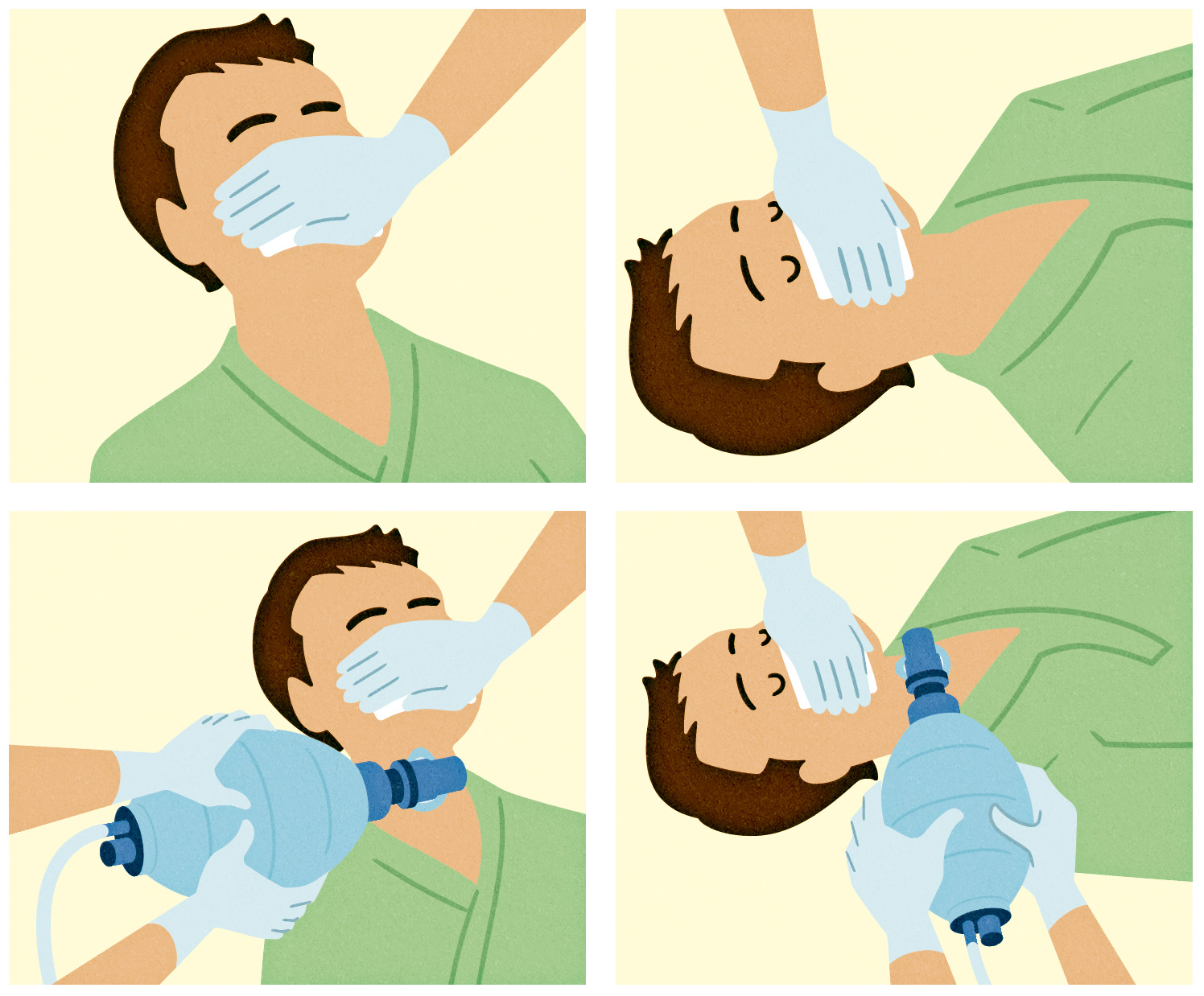 フクイヒロシ エキスパートナース6月号の付録 人工呼吸ケアmini Book にてイラスト描かせていただきました 気管切開チューブの固定が不十分だったりする場合に 事故抜去したときの対応について 口 気管切開部からの換気方法と気管切開部からのバッグ