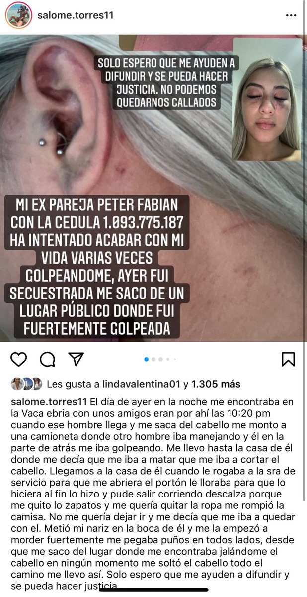 jhonjacome's tweet photo. En Cúcuta, esta joven denunció en su cuenta de Instagram que su expareja la sacó anoche de un establecimiento en contra de su voluntad, la subió a la fuerza a una camioneta y la golpeó brutalmente. No la conozco, pero hago público su caso porque manifiesta temer por su vida. https://t.co/mMHkhp5OzH