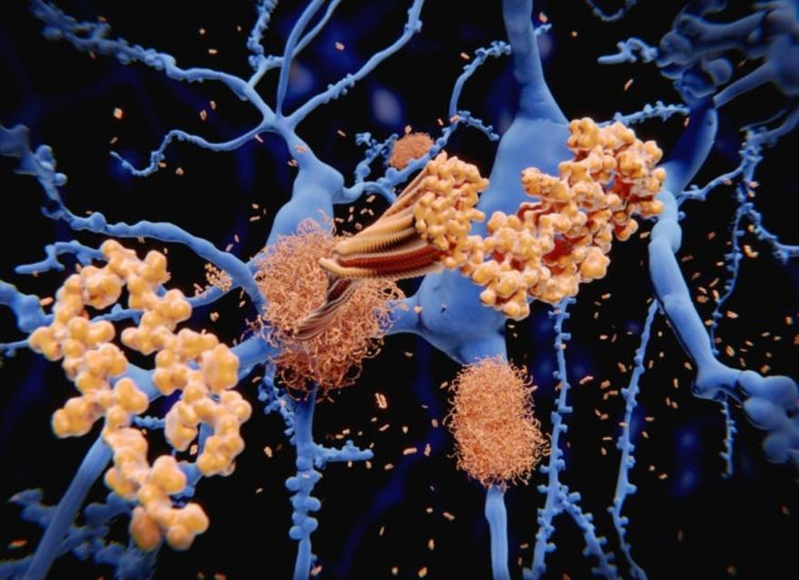 you might wonder why the brain has a cleaning system in the first place? it's because toxic proteins like amyloid beta plaques (Aβ) build up daily in your grey matter and not cleaning them out would be detrimental, as having a lot are linked to alzheimer's disease, aging, etc.