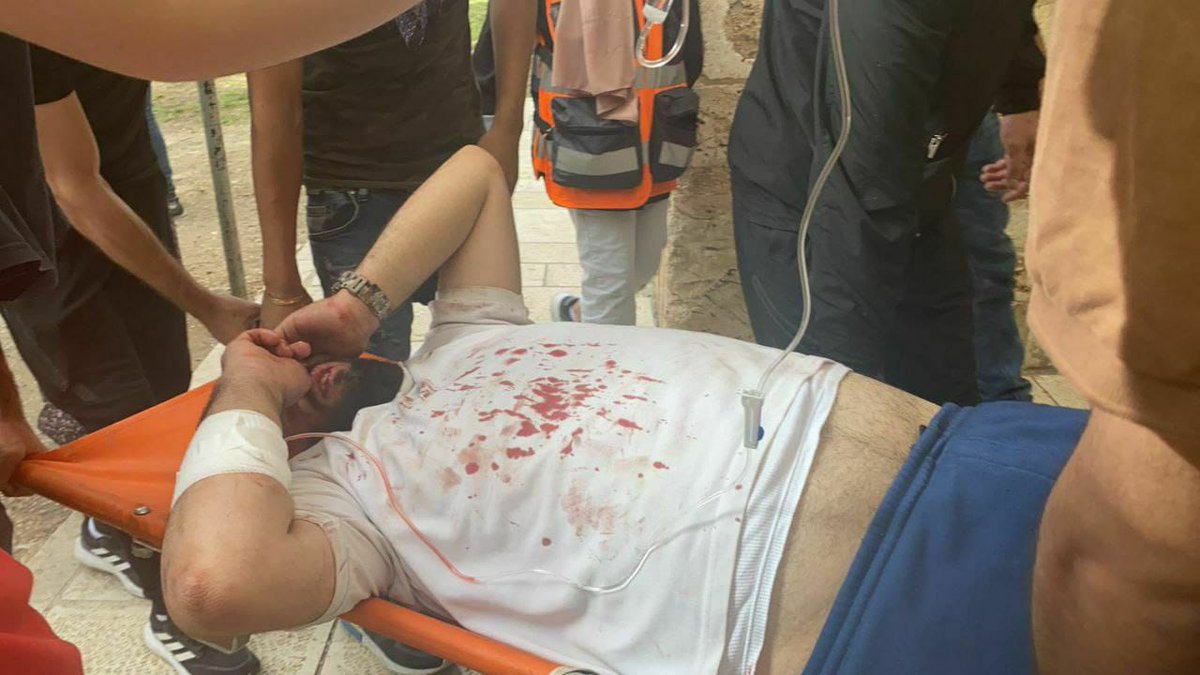 Photos of injuries among Palestinian worshippers in Al Aqsa Mosque Yard