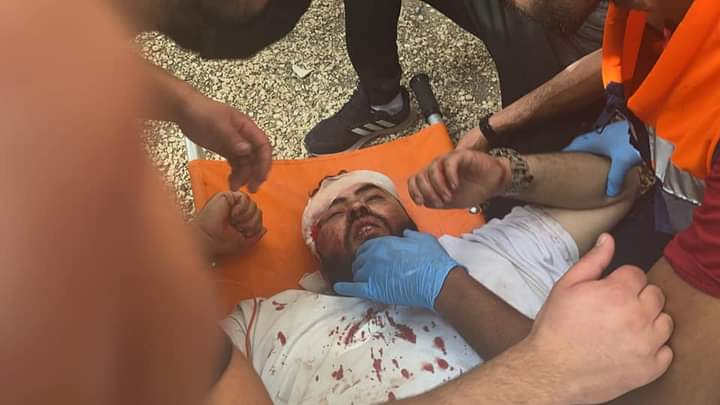 Many injuries inside Masjid al-Aqsa