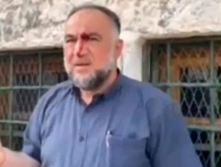 Many injuries inside Masjid al-Aqsa