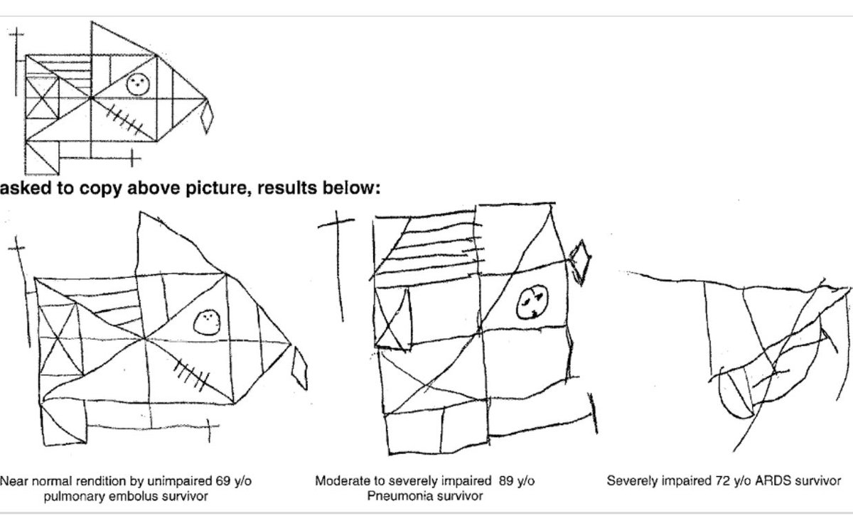 4/ Most brain  loss following  #CriticalCare time is from our frontal lobes & hippocampus, which causes problems with executive function & memory problems. See this previously normal person’s new inability to draw the figure months into recovery.Paper:  https://bit.ly/3o0l6PA 