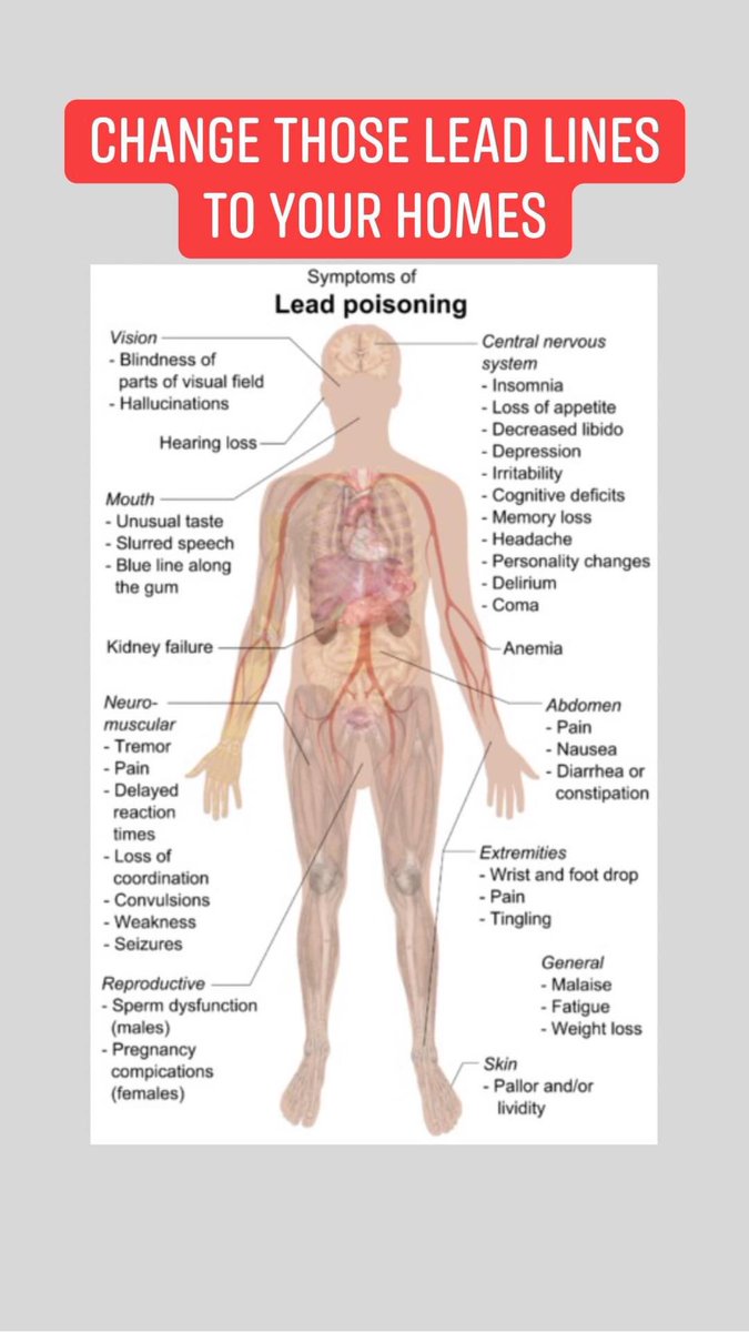 #MA residents pls have your #leadlines changed for your homes, call your local municipality and or Rep/Senator to find out how! #leadpoisoning is no joke #look pls. You don’t want to make #baby  formula or cook with it if you have lead in water! fetuses to seniors  #mapoli