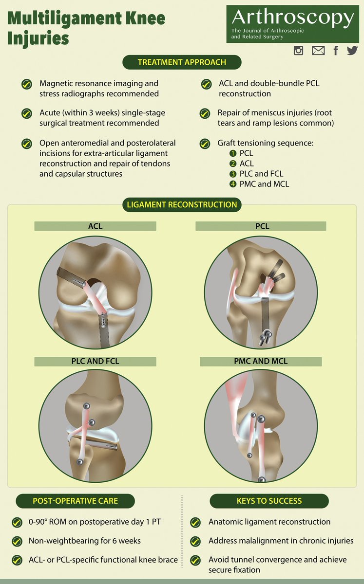 ArthroscopyJ's tweet photo. Keys to success in multiligamentous knee reconstructions... 
@thekneedoc #knee #injury #sportsmedicine #physicaltherapy
Original graphic:
https://t.co/1M6i3Xj4LB https://t.co/P6Ni0DFY8L