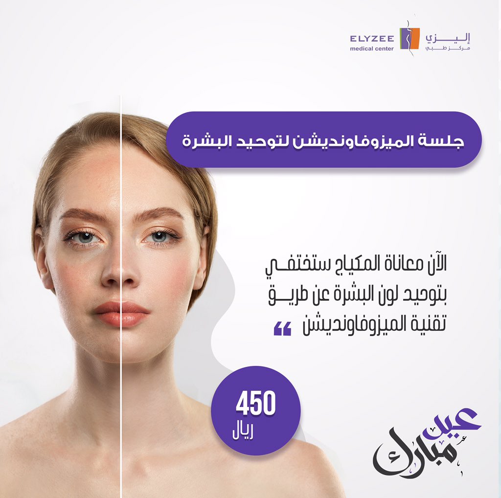 ElyzeeCenter's tweet photo. نهنئكم بمناسبة قرب حلول عيد الفطر المبارك. أعاده الله علينا وعليكم باليمن والبركات ❤️✨ 
ونقدم لكم عروض العيد المميزة. سنتغيب لإجازة العيد بدءاً من يوم الخميس وإلى يوم الإثنين. ونستقبلكم يوم الثلاثاء الموافق ٦/١٠/١٤٤٢ https://t.co/xrhCzh6zLE