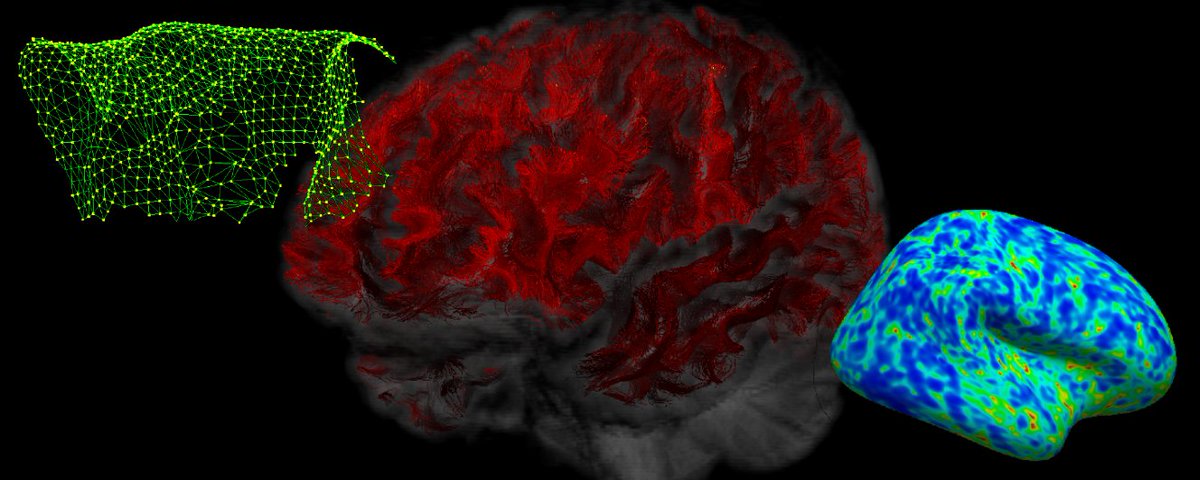 Glad to finally share our Short Association Fibre Tractography #preprint today! <a href="/drsilagenc/">Sila Genc</a> G.D.Parker <a href="/Kristin_Koller/">Kristin Koller</a> <a href="/ChantalTax/">Chantal Tax</a> @cjohnevans @khalidhamandi W.P.Gray @Dee_Kay_Jay <a href="/MaxChamb/">Maxime Chamberland</a> <a href="/CUBRICcardiff/">CUBRIC</a> <a href="/biorxivpreprint/">bioRxiv</a>  

biorxiv.org/content/10.110…