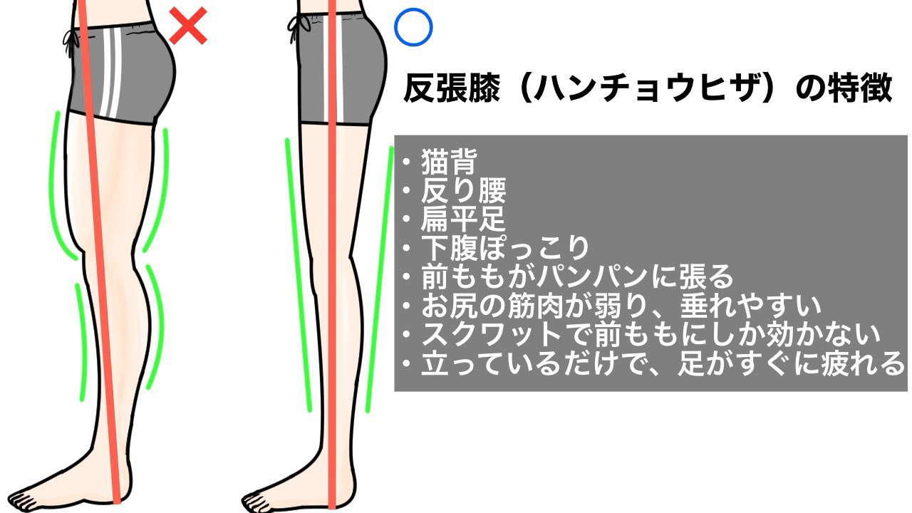تويتر ユウトレ 膝パカ本 大好評発売中 على تويتر 反張膝改善動画はこちら 1日1セット5分でできます T Co Byucgadlj9 前ももがパンパン お尻が垂れてきた 立ち姿勢でひざをまっすぐ伸ばしている 体重は減っているのに 脚だけ細くならない