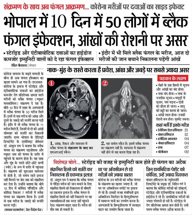 अपनी खुद की जितनी सुरक्षा रख सको...रखो। सरकार के पास जनता की जान से ज्यादा इम्पोर्टेन्ट ओर भी बहुत काम है, और वैसे भी सरकार जिस ढंग से काम कर रही है उतने में बहुत नुकसान हो जायेगा।
So please ...Be safe...Stay home.
#7YearsIndiaInTears