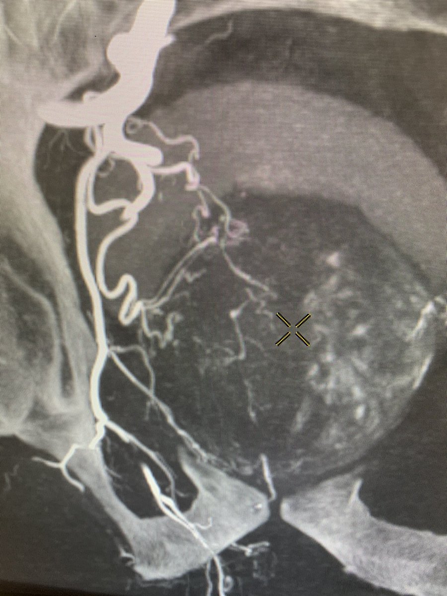 Ari Isaacson tweet media