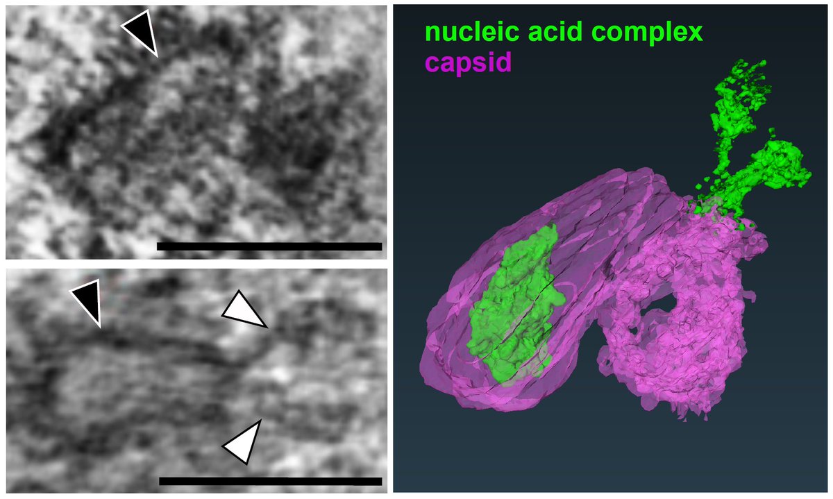 Thorsten Müller (@thorstenmllr) on Twitter photo New data on HIV-1 nuclear uncoating and visualization of viral DNA now published in <a href="/eLife/">eLife - the journal</a>: elifesciences.org/articles/64776
Thanks to <a href="/VojtechZila/">Vojtech Zila</a> @SandraSchffrdck <a href="/BojanaLucic/">Bojana Lucic</a> <a href="/metavibor/">Vibor Laketa</a> and others not on twitter <a href="/CiidHeidelberg/">CIID_Heidelberg</a>.
See thread
1/10 New data on HIV-1 nuclear uncoating and visualization of viral DNA now published in <a href="/eLife/">eLife - the journal</a>: elifesciences.org/articles/64776
Thanks to <a href="/VojtechZila/">Vojtech Zila</a> @SandraSchffrdck <a href="/BojanaLucic/">Bojana Lucic</a> <a href="/metavibor/">Vibor Laketa</a> and others not on twitter <a href="/CiidHeidelberg/">CIID_Heidelberg</a>.
See thread
1/10