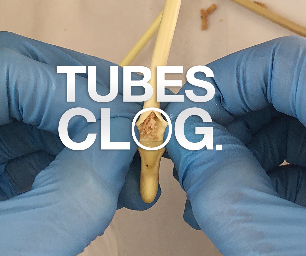 ActuatedMedical's tweet photo. Did you know it is estimated that 5 million U.S. patients receive nutrition via feeding tubes. Feeding tube clog rates have been cited as high as 35-45%. On Wednesday we will see how Actuated's TubeClear System can optimize nutrition delivery. #MedTechMonday https://t.co/PBHGNdzItB