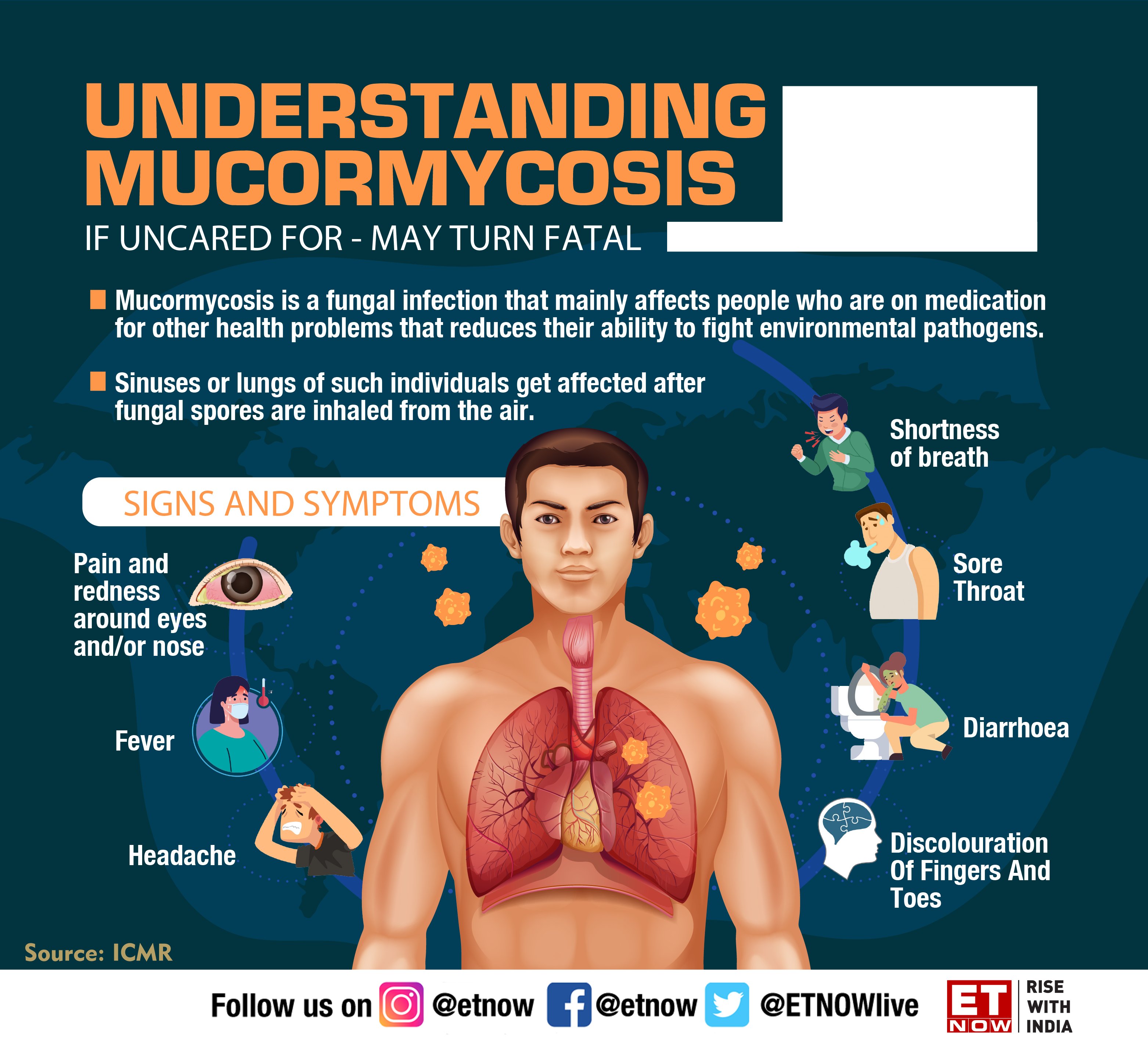 Et Now 在 Twitter 上 Blackfungus What Is Fatal Black Fungal Infection Among Covid Recovered People It Is Mucormycosis Here S All You Need To Know About It Pmoindia Drharshvardhan Mohfw India Rajeshtope11 T Co Mahdpwv8zr