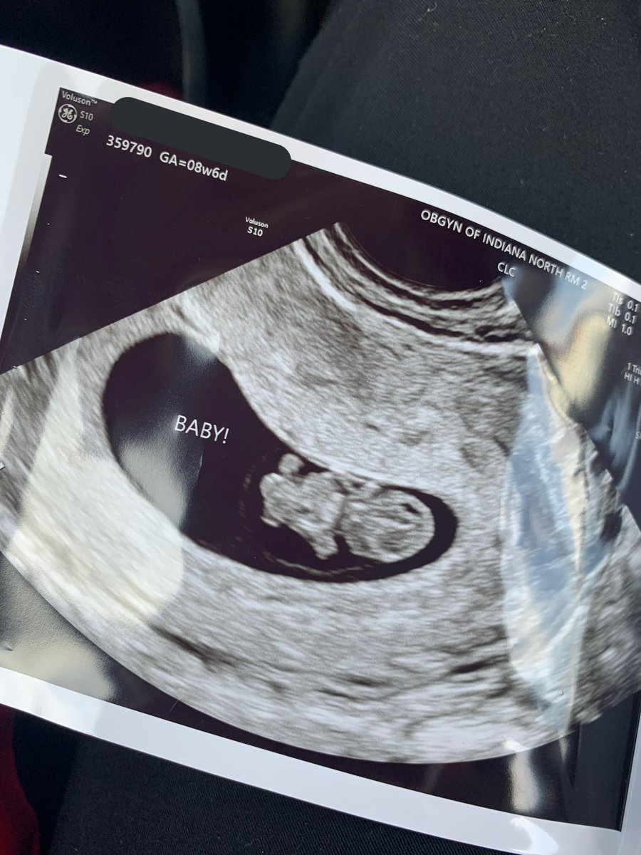 CassidyNicole97's tweet photo. can’t wait for little one to arrive 🥺 https://t.co/o5DJdNSoge