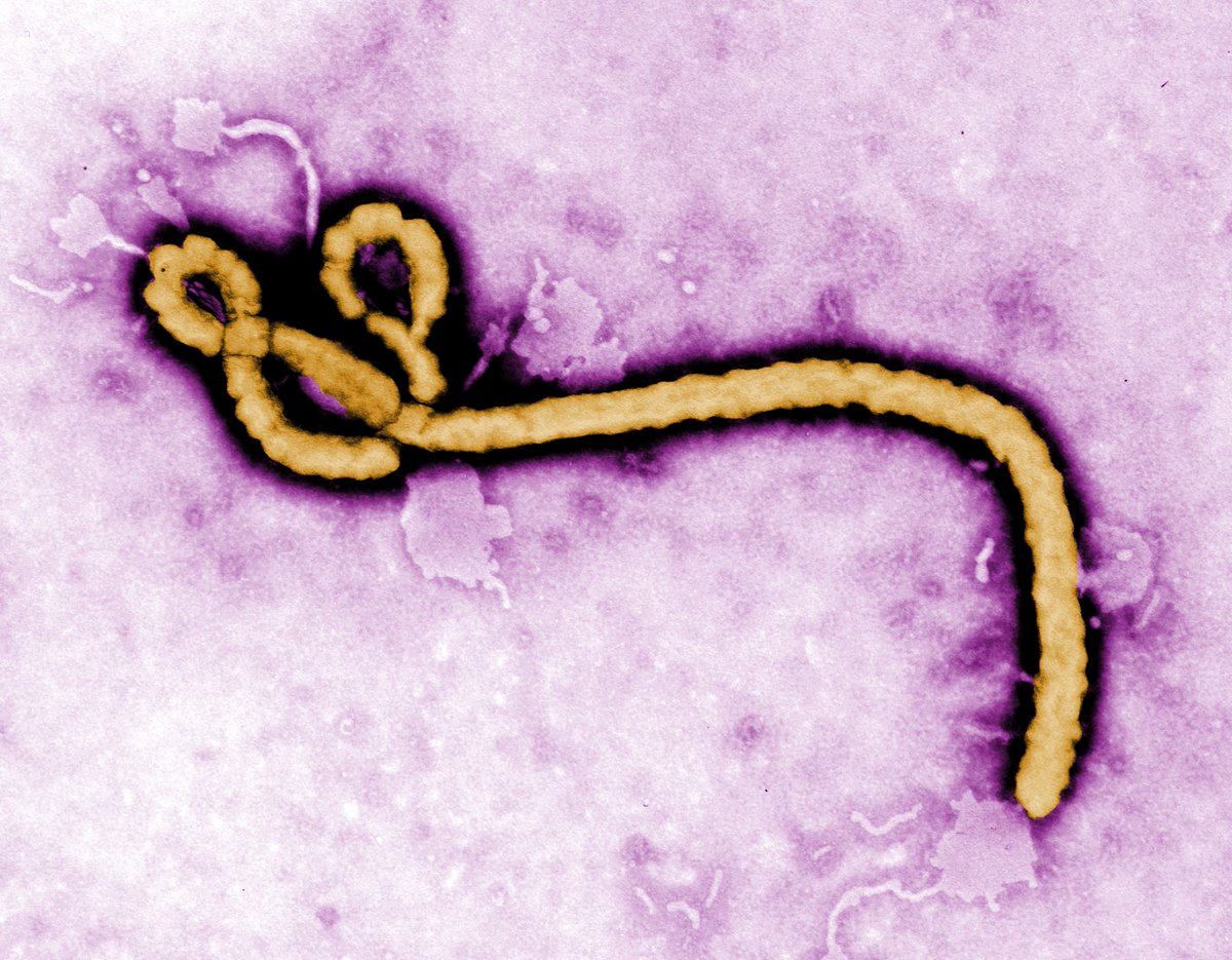 utmbnews's tweet photo. While we are still dealing with the COVID-19 pandemic, UTMB researchers are also keeping an eye, and doing groundbreaking research, on other deadly diseases. UTMB scientists were awarded $11.3 million for new studies on #Ebola 
https://t.co/dCXXO4WfJN https://t.co/X8CSNqyQCG