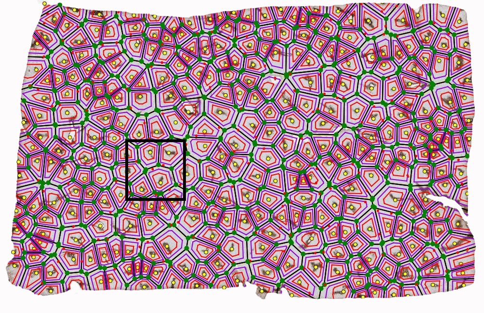 When pathology meets computational geometry:  Voronoi-based liver zonation algorithm built solely from the location of central veins. Many novel zonation tools for digital analysis in the works.  Big thanks to the whole team!! nature.com/articles/s4159…