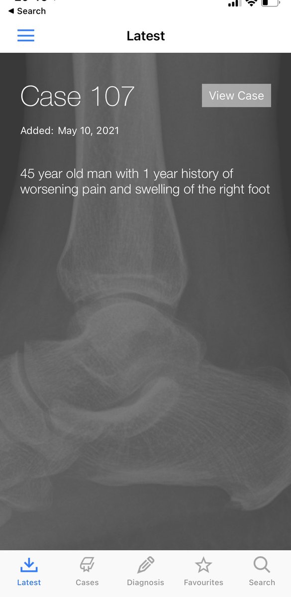 BoSTT_app's tweet photo. Check Case 107 @BoSTT_app . Bone tumour, multifocal ;-) #BSTpath #MSKradiol #radiology #pathology #sarcoma #FOAMed #FOAMrad https://t.co/ospXlrV5wU