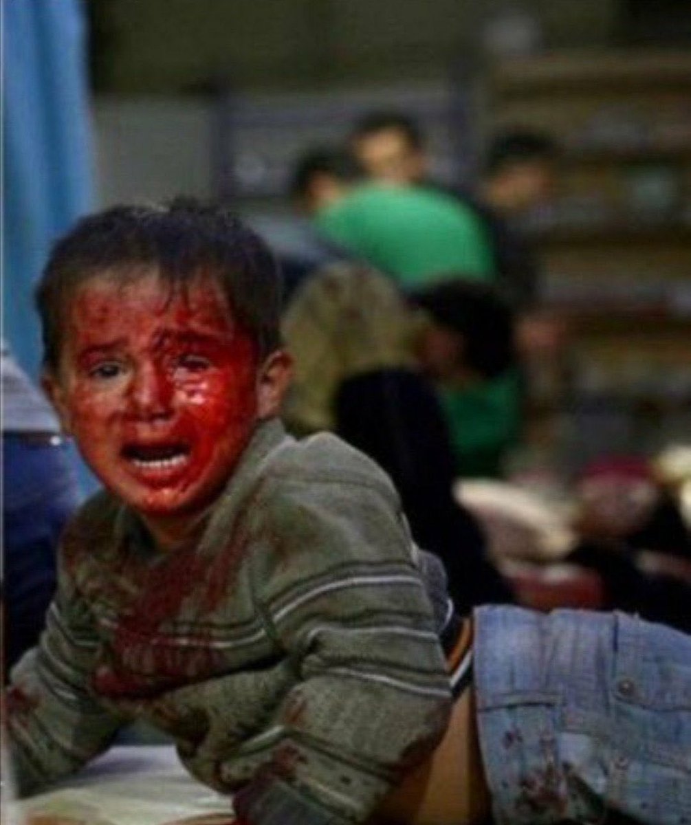 İzlemeye ve kınamaya devam ettikçe bu zulüm durmayacak. Kukla Mahmud ABBAS ve Filistin yönetimi indirilmeli. Komşu Arap ülkeleri ile Türkiye bir araya gelmeli. Sert adımlar atılmak zorunda. Kınamak çözüm değil. 
#AksadaBaskınVar #Kudues