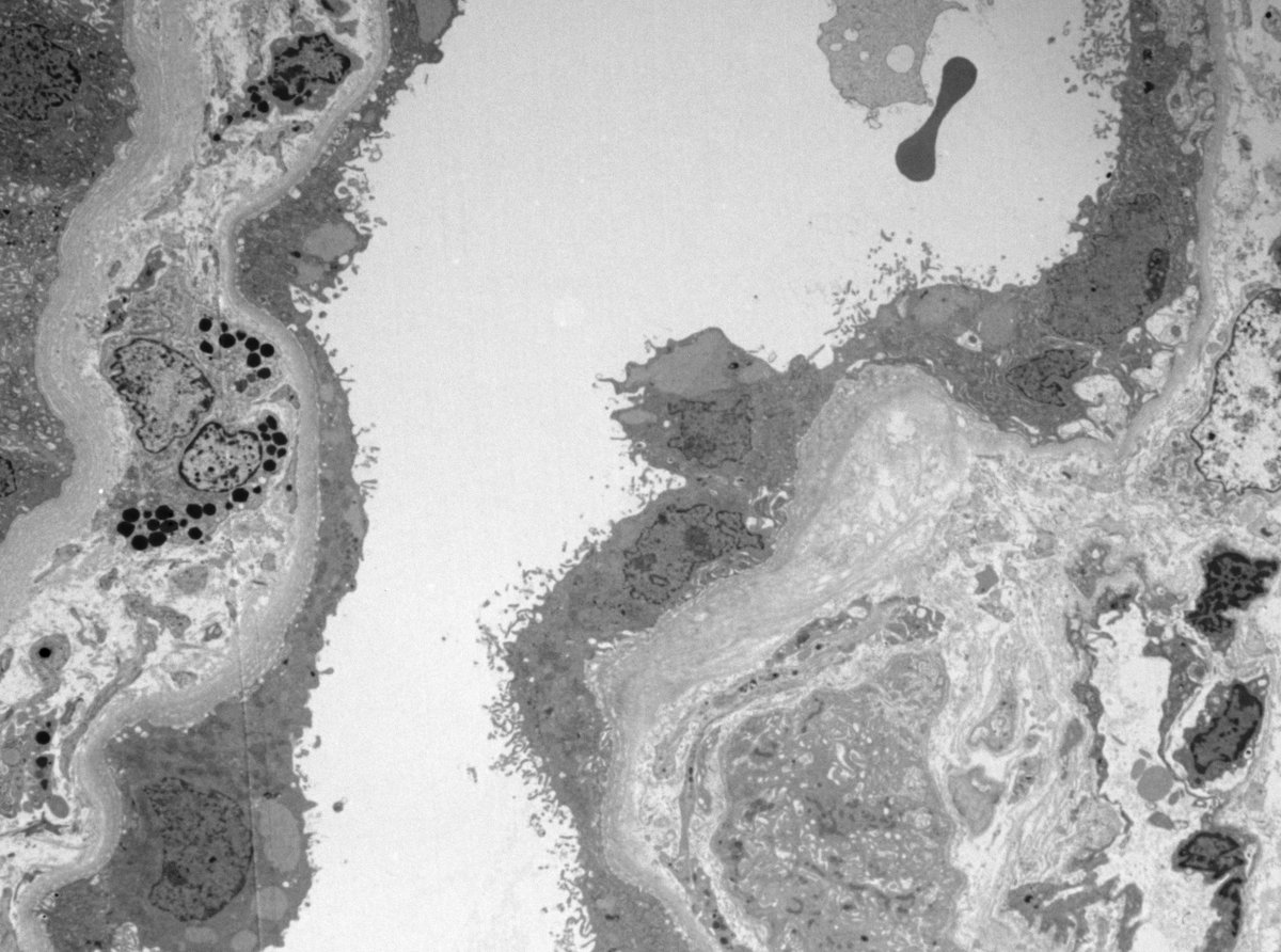 Jean Hou, MD tweet media