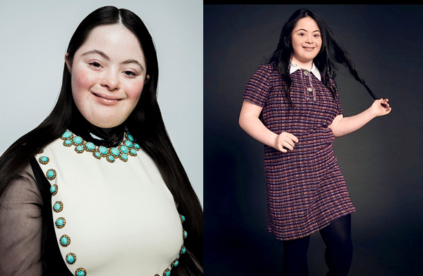 Ellie Goldstein - Making her #GUCCI #2020 Debut #fashionista #inclusion #DownsyndromeBeauty