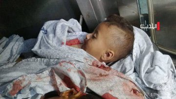 Çocuk her yerde çocuk değildir;
Suriye'de kayıptır..
Yemen'de aç'tır..
Gazze'de şehittir..
Afrika'da işçidir..
Afganistan'da yaralıdır..
Irak'da yetimdir, öksüzdür..
Türkistan'da mazlumdur.!
#AksadaBaskınVar #AlAqsaUnderAttack