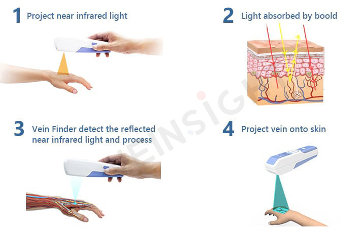 FinderVein's tweet photo. VeinSight™ #VeinFinder adopts the latest #veinvisualization technology, it projects harmless near-infrared light onto the skin, which is absorbed by hemoglobin within the blood and reflected by surrounding tissue. 
Learn more: https://t.co/6pMonkPoWX
#medicaldevices #healthcare https://t.co/P9CF2SgRbE