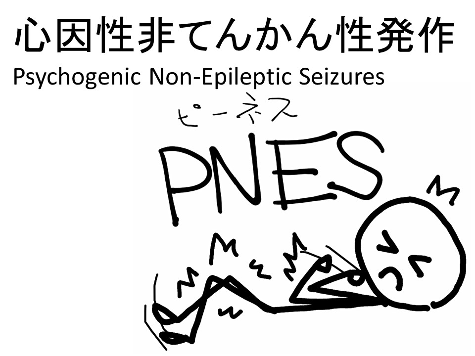 てんかん症候群 (新品)-
