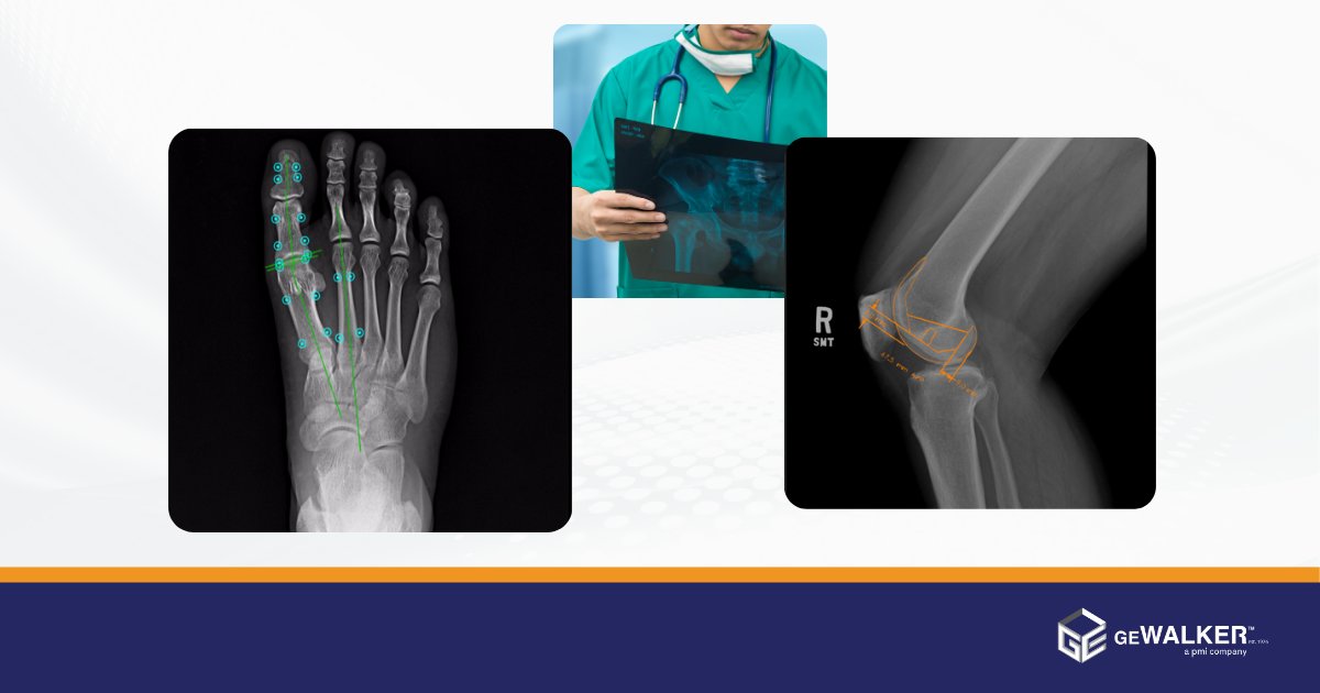 gewalkerinc's tweet photo. Here at G.E. Walker we serve a multitude of different industries ranging from Cardiology and Orthopedics to Women's Health and Podiatry, and much more. Visit https://t.co/99T7ujmXm2 to discover more about our clinical specialties today. #medicalimaging #medtech https://t.co/8iHZ2nqxI2