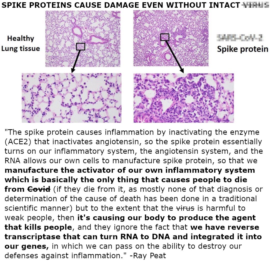RaypeatT's tweet photo. Spike proteins cause damage even without the intact v!ru5. The image shows lung damage. https://t.co/p18aiK2VY9