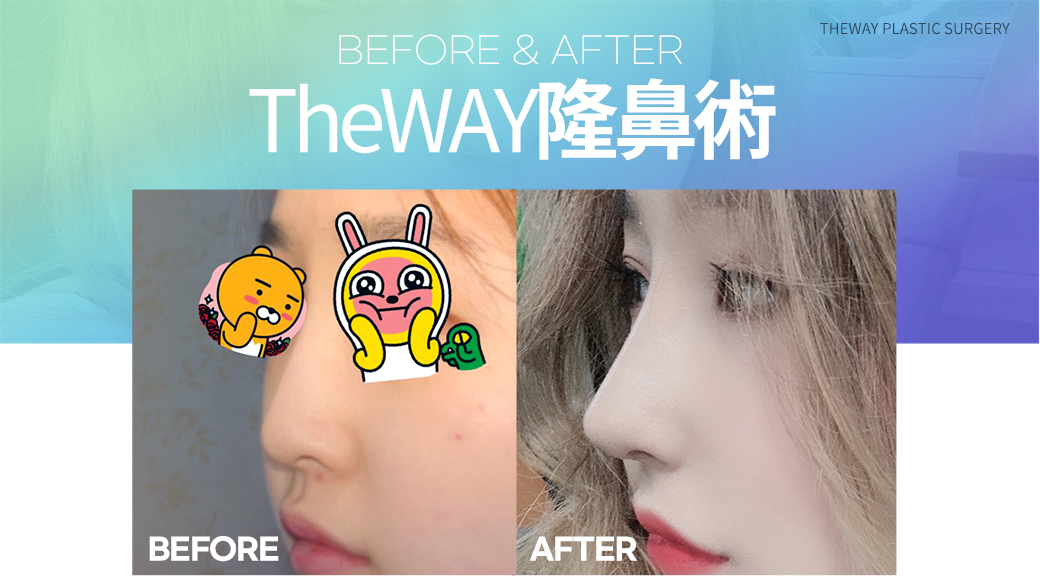thewayps's tweet photo. 顔を輝かせるきれいな鼻ライン~
ザウェイ鼻整形~
#鼻整形 #隆鼻 #鼻先 #鼻中隔延長 #団子鼻整形 #鼻翼縮小術 #tiprefinement #鼻先縮小術 #韓国美容外科 #ザウェイ美容外科 https://t.co/do1hExUySC