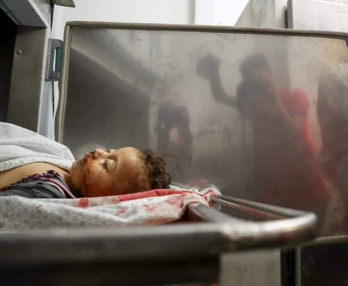 This is the 'terrorist' that 'Israel' defends itself from him!
#GazaUnderAttack