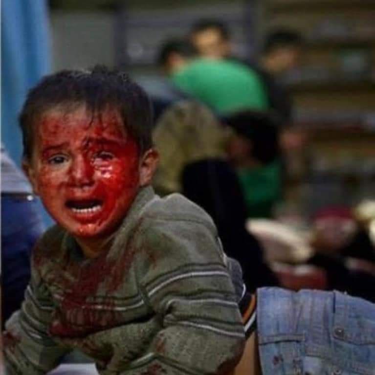 #FilistindeCocuklarÖlüyor
#MescidiAksadaBaskınVar
#IsrealTerrorıst