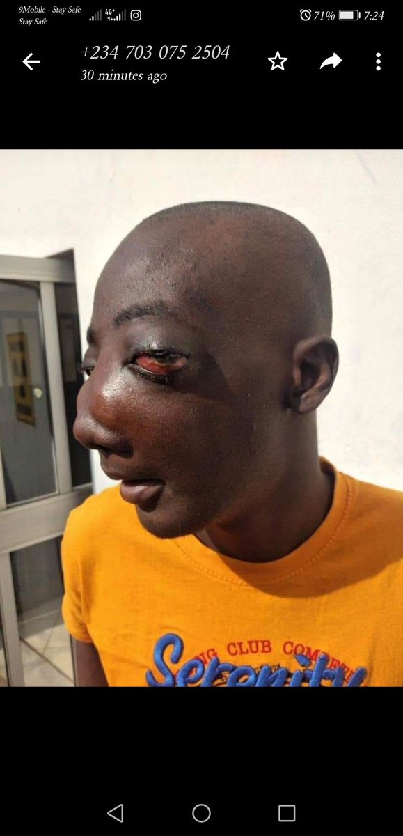 _iamtomi's tweet image. Please help save Brown - Donate - Retweet 

Victor AD #lockdown Israel