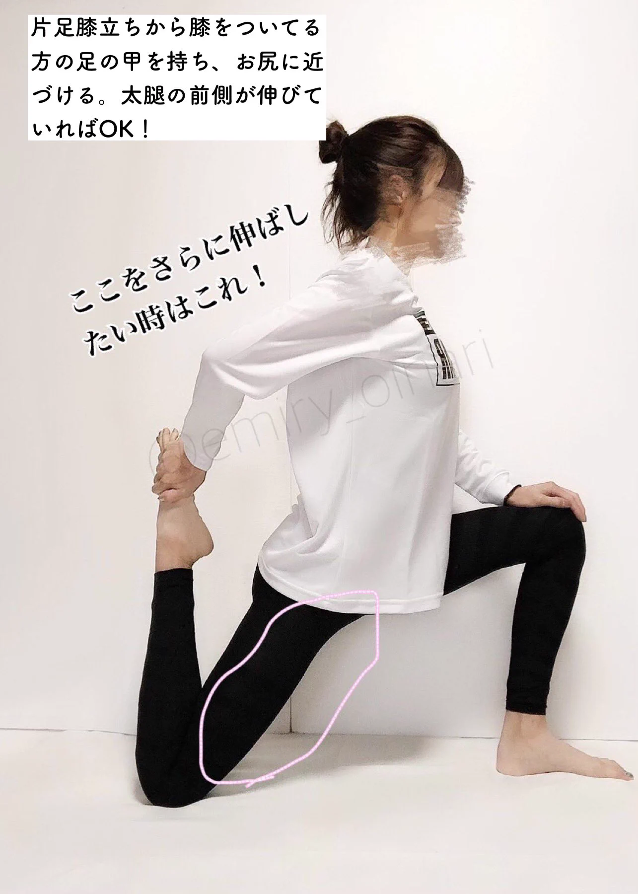 「反張膝」にお困りの方におすすめのストレッチ！そして普段から姿勢に気をつけましょう！