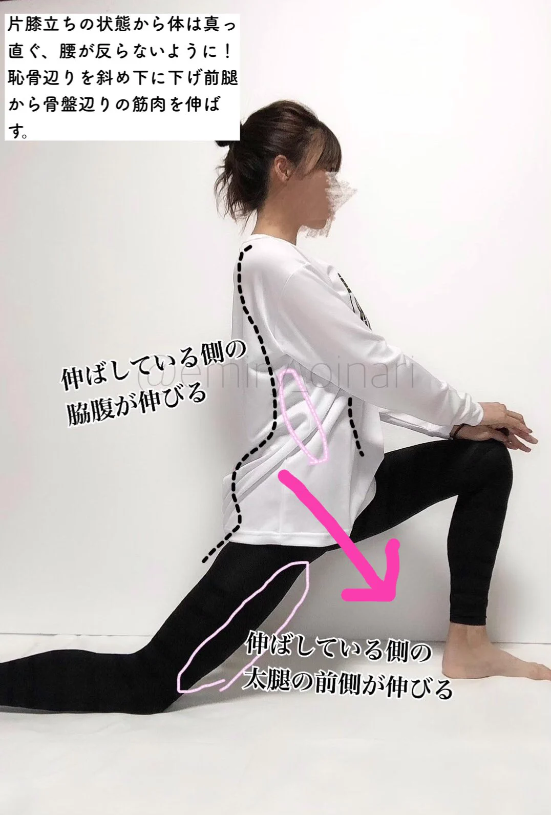 「反張膝」にお困りの方におすすめのストレッチ！そして普段から姿勢に気をつけましょう！