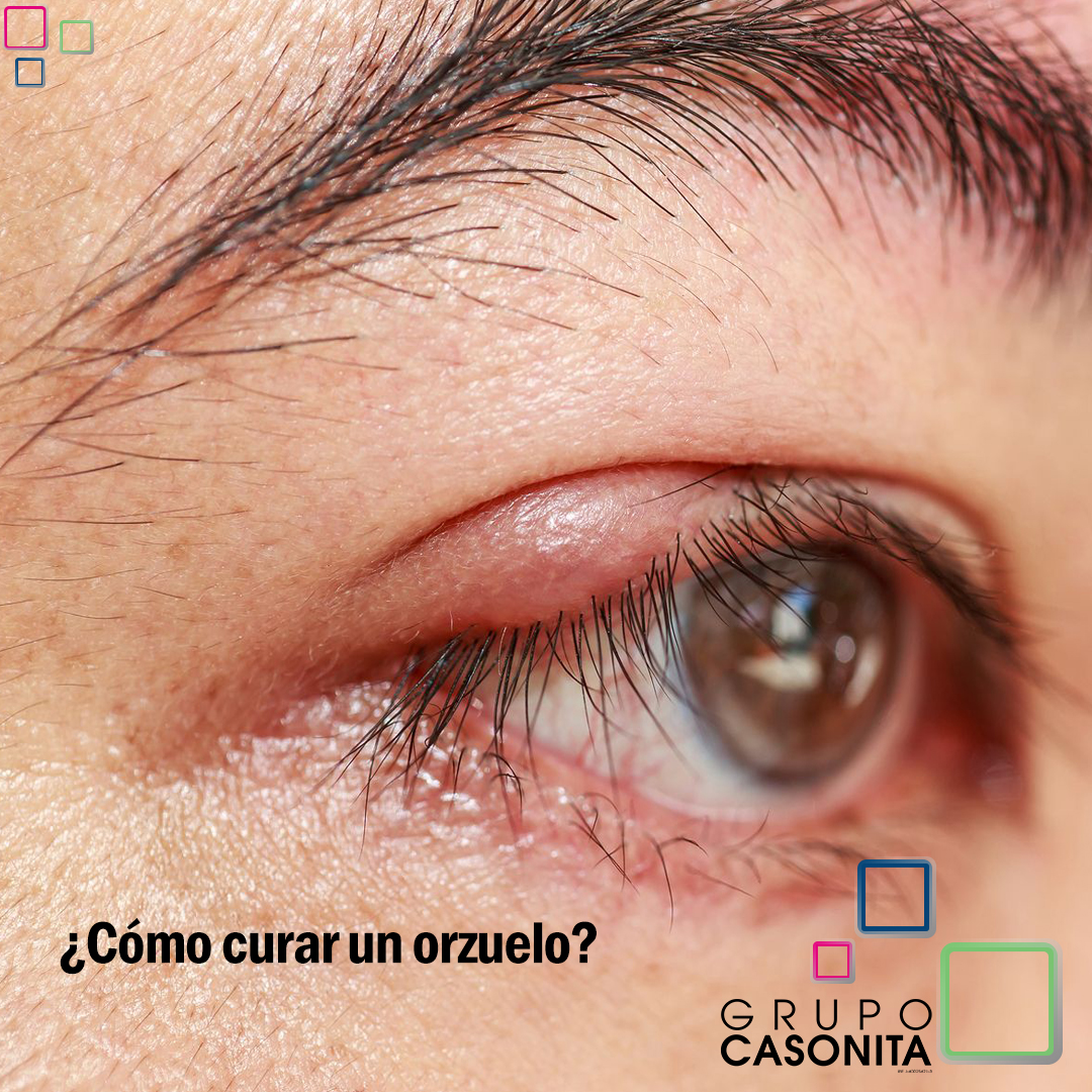Grupo Casonita tweet media