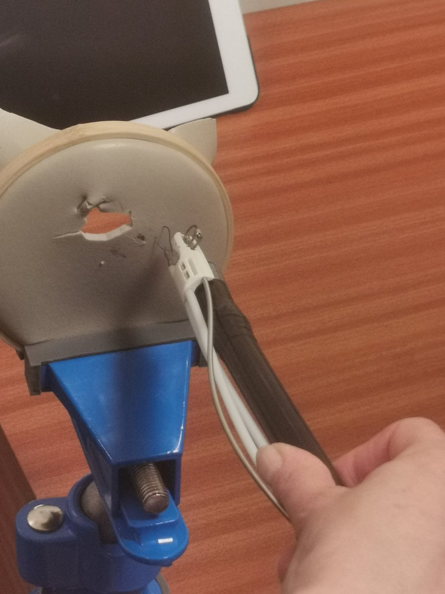 annaReichelt2's tweet image. Endostich training at Endoscopy LRI today. Another advancement in endoscopy meaning we can close defects and fix stents in place improving patient outcomes. #innovation #endoscopy #universityhospitalsofleicester #uhl #improvement #appollo