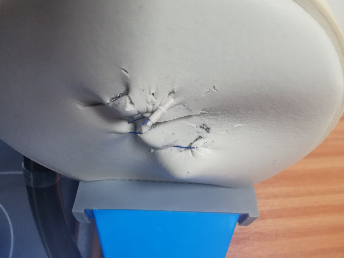 annaReichelt2's tweet image. Endostich training at Endoscopy LRI today. Another advancement in endoscopy meaning we can close defects and fix stents in place improving patient outcomes. #innovation #endoscopy #universityhospitalsofleicester #uhl #improvement #appollo