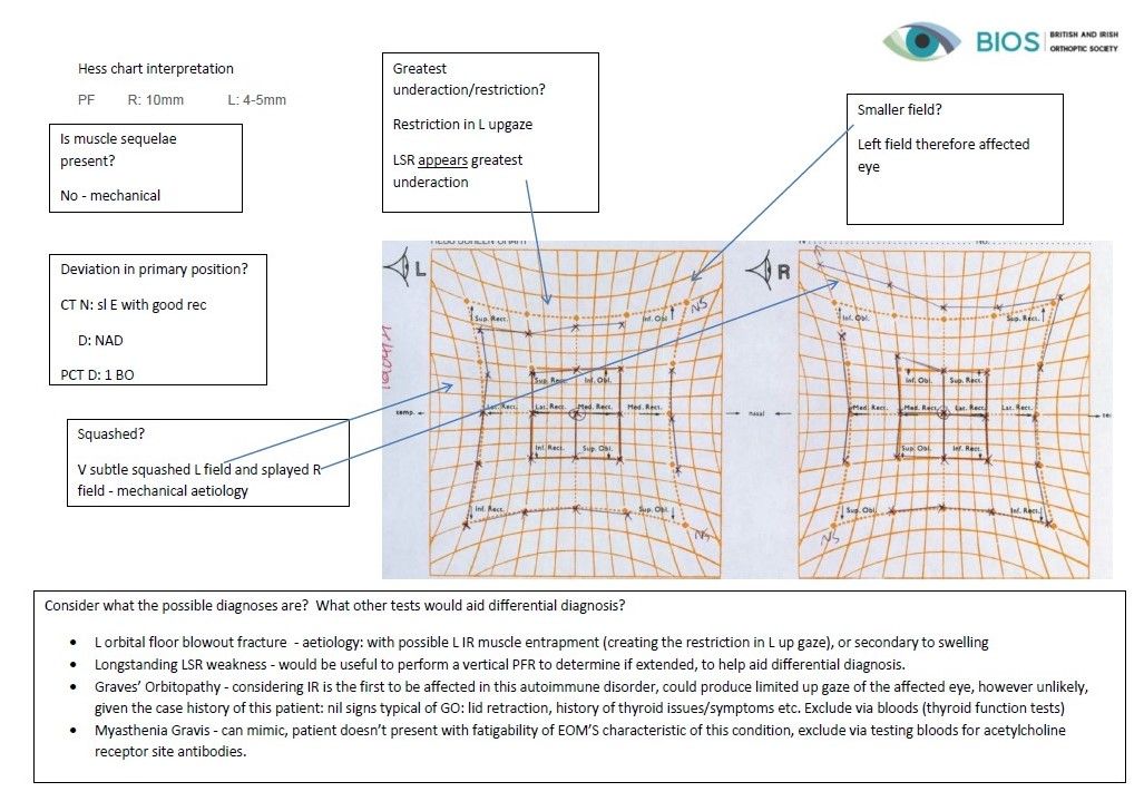 Thankyou to the <a href="/LeedsHospitals/">Leeds Teaching Hospitals</a> Orthoptic department for their really interesting and detailed resources for our Placement Resource Library!

Heads, please encourage your staff to contribute in this way!!!

View all our example resources here: buff.ly/3vDs5RW