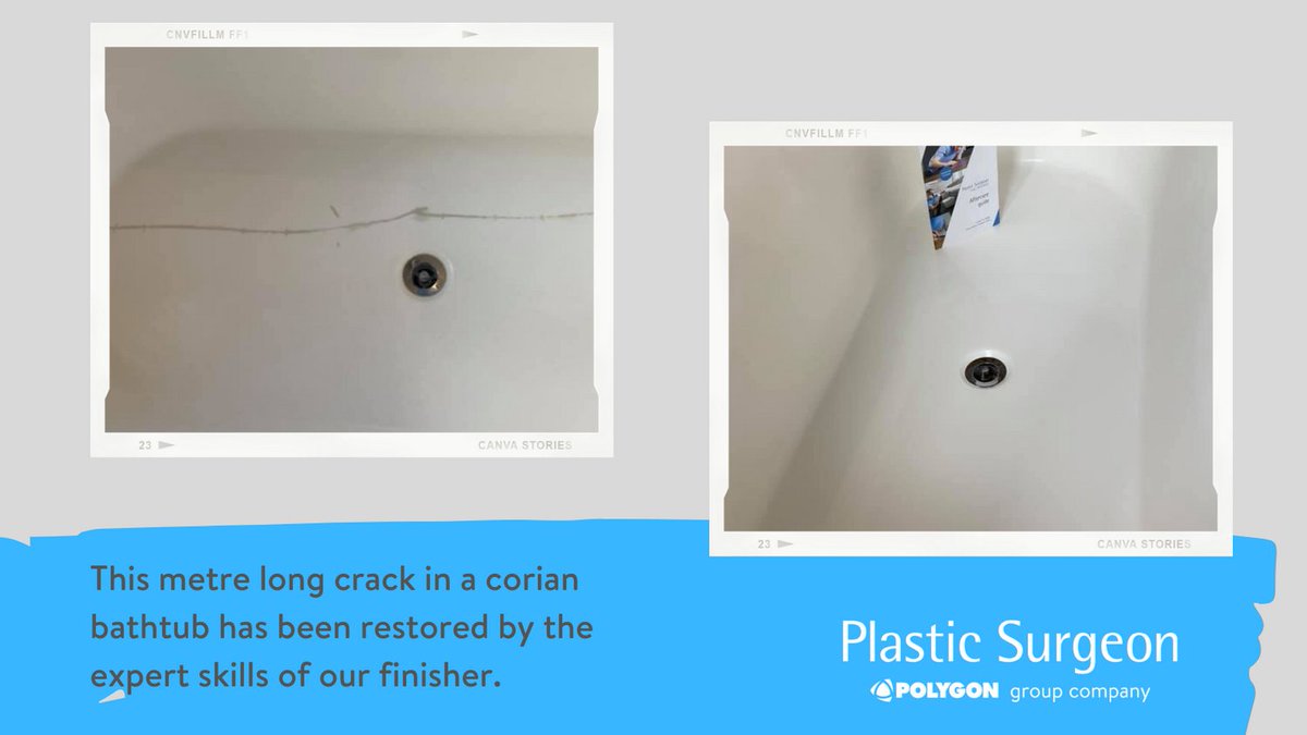 This crack mysteriously appeared in the bottom of a solid corion bathtub and so rather than replace it, our team repaired the damage with minimum fuss to the occupier.
plastic-surgeon.co.uk
#bathrepairs #sustainableoption #reducelandfill #restoration