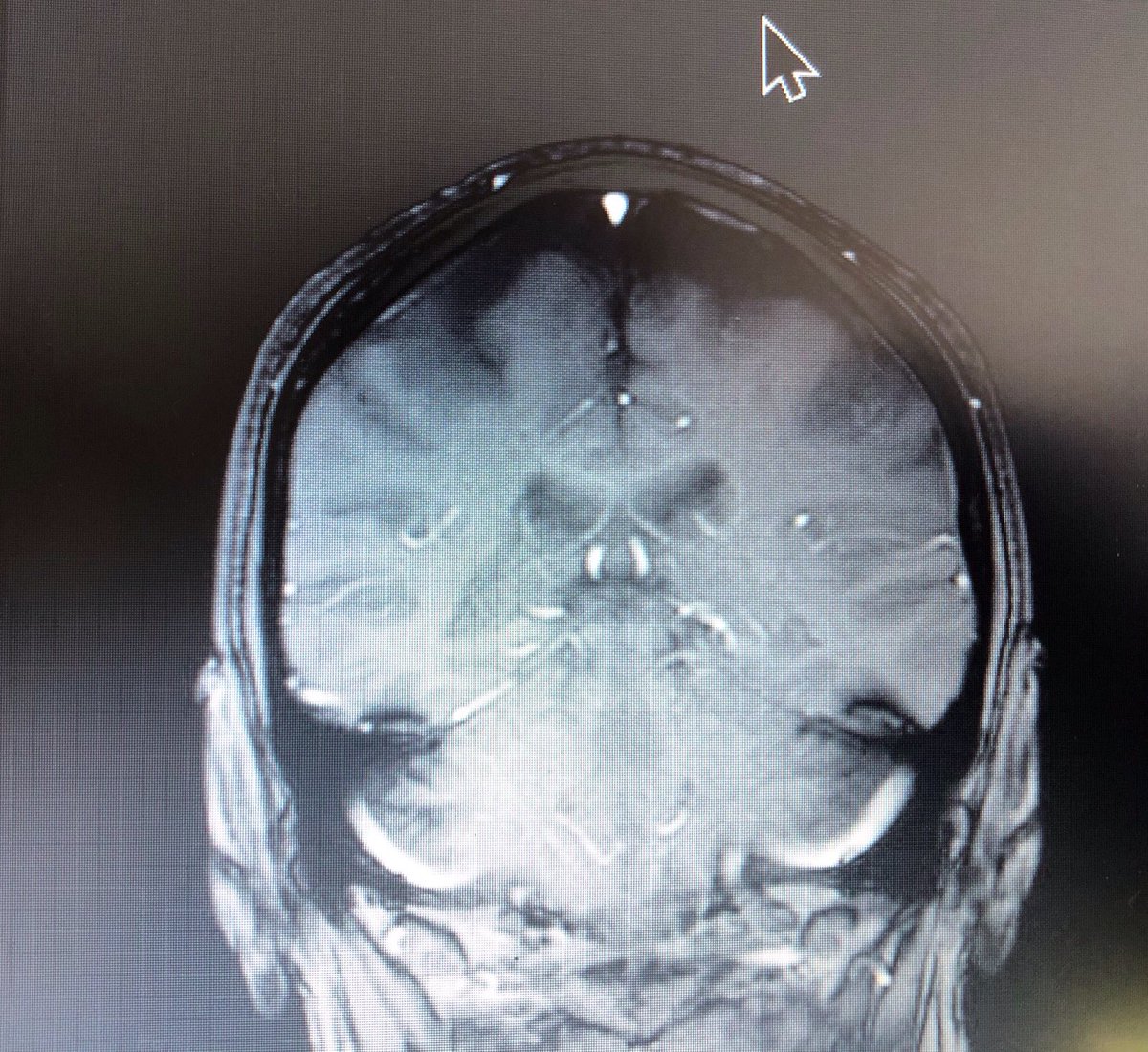 Willy Gilder tweet media