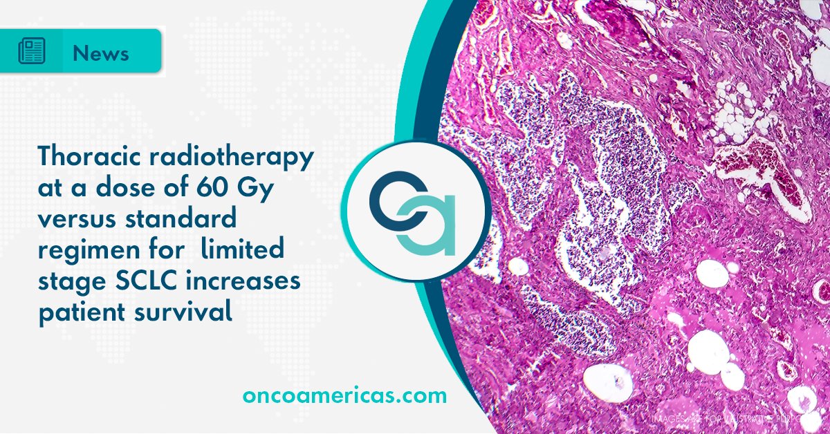 The researchers concluded that the higher dose of radiotherapy led to a survival gain compared to 45 Gy, without increase in toxicity.  
Read the full details: bit.ly/3vYL74p 
#cancer #lungcancer #SCLC #radiotherapy #oncology #OncoAmericas