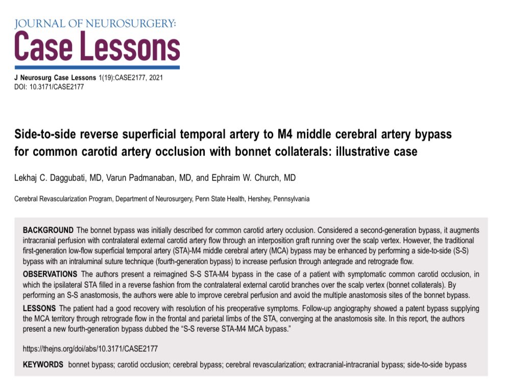LDaggubatiMD's tweet photo. Latest #nsgy publication on a side-to-side #STAMCA bypass for symp #ICAstenosis. With Strong CL collaterals, or “#BonnetCollaterals,” the S-S technique provided improved flow for the #bypass.
@ewchurchMD @v_padmanaban @PennStNeurosurg #Neurosurgery
https://t.co/AaVBCJuIh3 https://t.co/FpYywYOWI1
