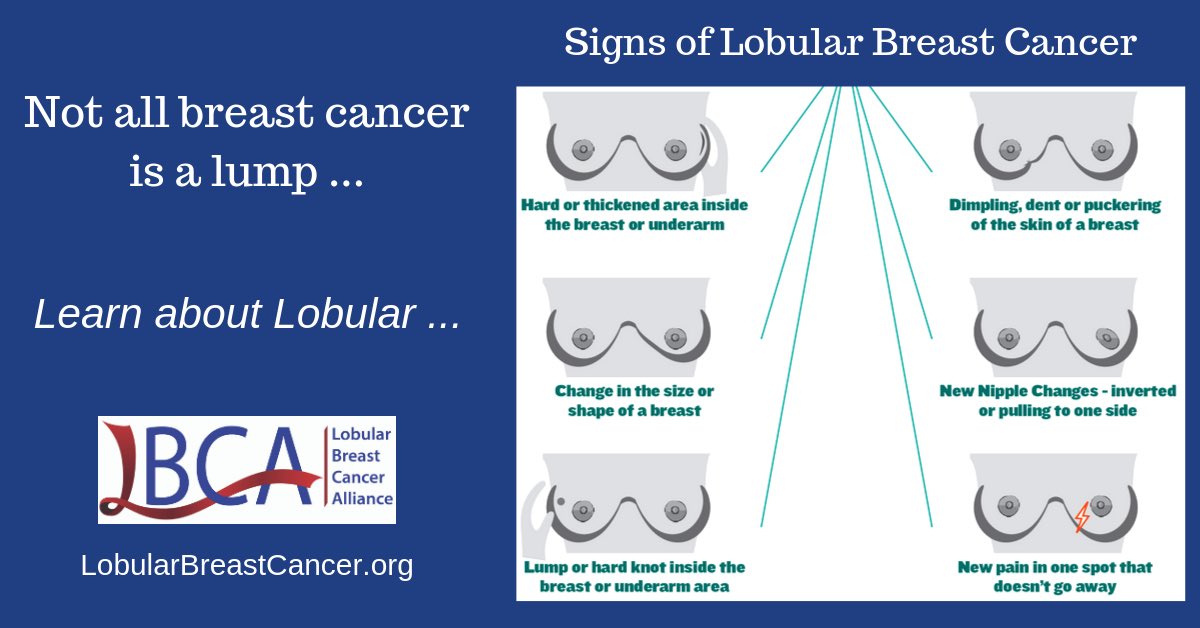 Lobular Breast Cancer Alliance tweet media