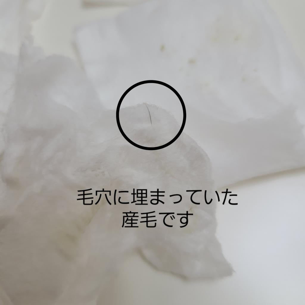 小顔矯正と美肌専門 Matoria マトリア Matoria9 Twitter