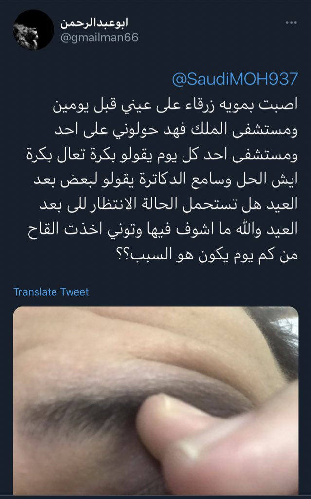 itstoolate_q8's tweet photo. بعد اللمْْاح بكم يوم اصيبت عينه الله يشفيه 

راح للمستشفى قالوا له بعد العيد !! 

طبعًا مشغولين أهم شي يلـ ـقـ حون الناس 

بأسرع وقت ‼️ https://t.co/KbDGDrfgeE