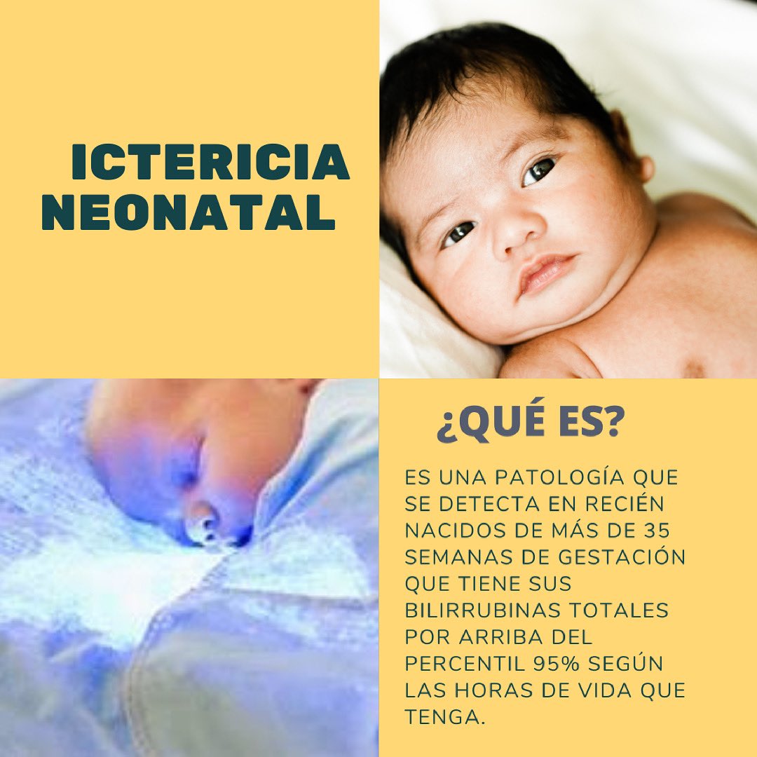 Ictericia Neonatal (@IctericiaN) / Twitter Ictericia Neonatal (@IctericiaN) / Twitter