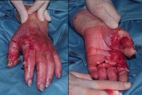 IsouBn's tweet photo. The Zionist army used bombs in Gaza.  And for those who do not know internationally prohibited bombs: White phosphorus is a weapon that works when the human body is exposed to phosphorous, it burns skin and flesh, leaving nothing but bone
#GazaUnderAttack 
#GazaUnderAttack https://t.co/5OEd9cvPB7